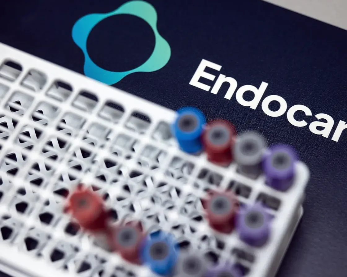 Probówki przygotowane do badań laboratoryjnych w Centrum Medycznym Endocare