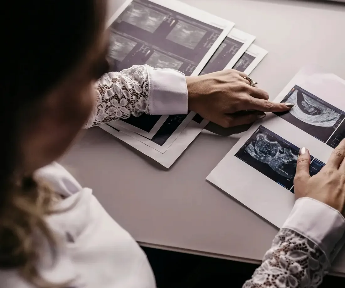 Lekarka analizuje wydruki z badania ultrasonograficznego miednicy